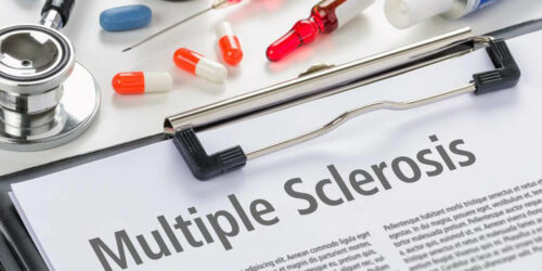 Most Promising New Multiple Sclerosis Treatment Options