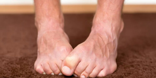 Neuropathy Foot Pain &#8211; Symptoms, Causes, Treatments and More