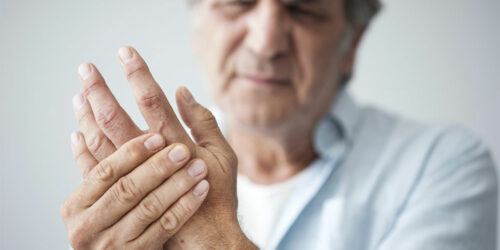 Rheumatoid arthritis – What is it and how to live healthy
