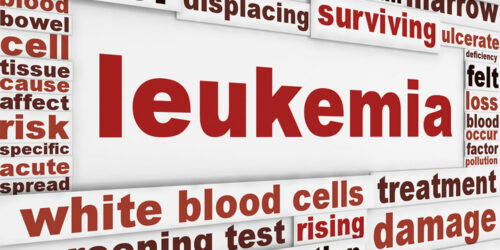 Symptoms, causes, and risk factors of leukemia