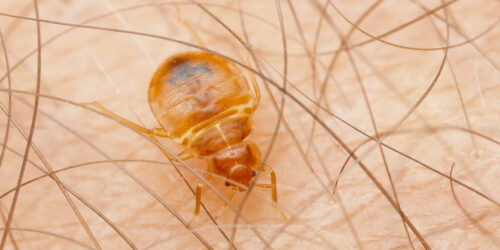 The Best Ways To Kill Bed Bugs