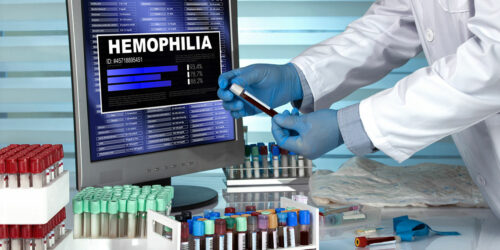 The Diagnosis and Prognosis of Hemophilia