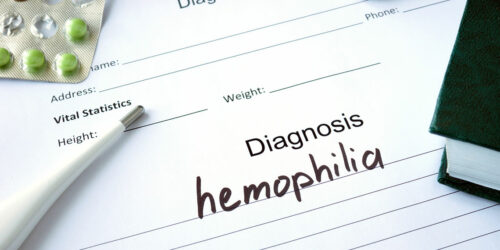 Three Factors to Consider While Living with Hemophilia