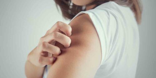 Uncover The Reasons Behind Itchy Skin