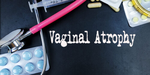 Vaginal Atrophy Treatment &#8211; An Overview