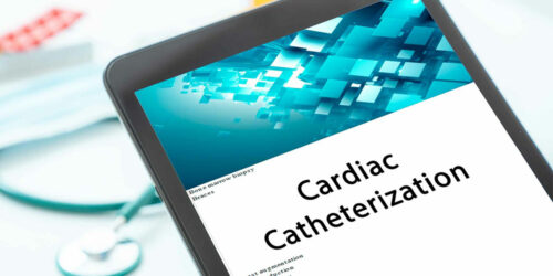 Everything to Know About Heart Catheterization Procedure