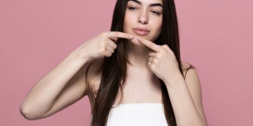 3 Ways to Manage Cystic Pimples