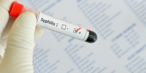 Syphilis – Early Signs and Diagnosis